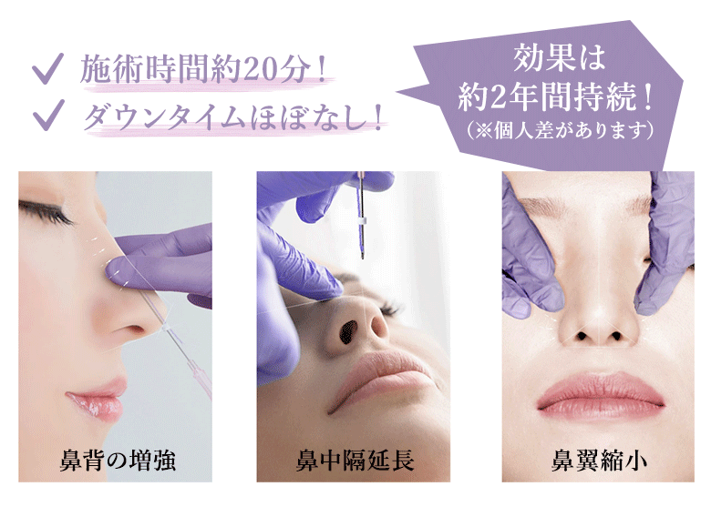 鼻を整える3つの施術
