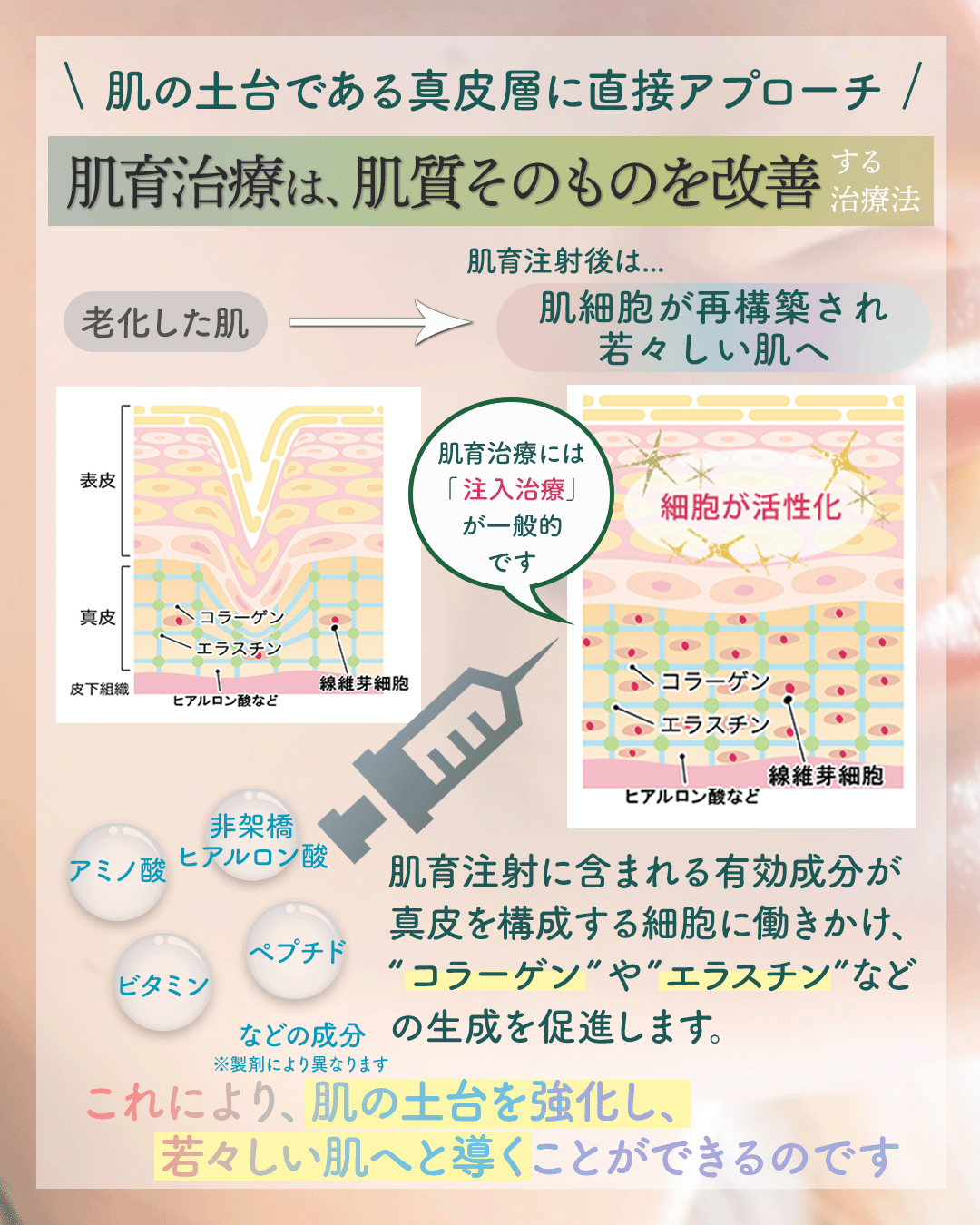 肌育治療とは